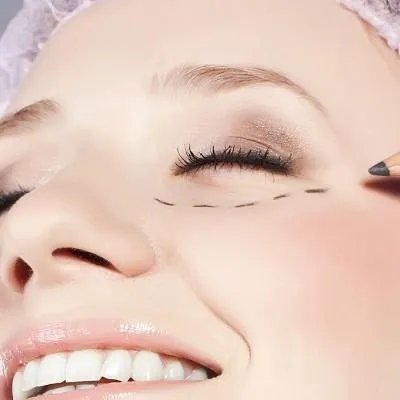 如何去除痘印疤痕