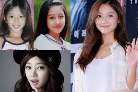 刘仁娜整容前后对比 刘仁娜承认自己整容