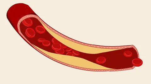 孩子头上突然长了硬包什么原因怎么办