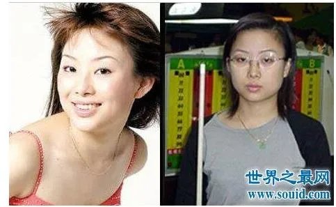 潘晓婷整容：潘晓婷一系列的整容对比照（图）