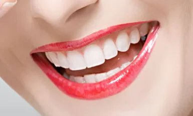 超声波洗牙多少钱