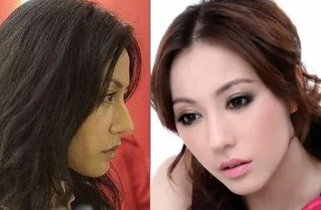 刘心悠整容前后照片曝光 揭秘刘心悠老公是谁