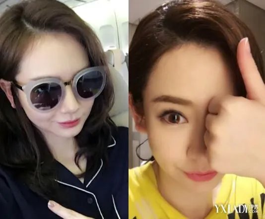 戚薇日本拍戏受伤脸部需缝补晒素颜自拍照向粉丝报平安