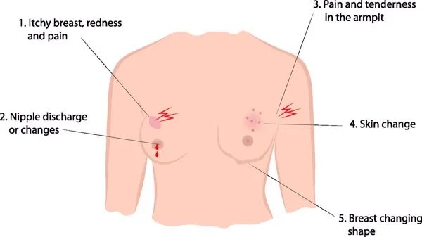 打针丰胸需要多少钱