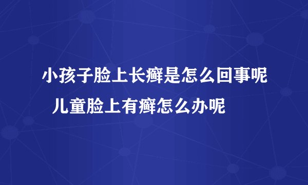 小孩子脸上长癣是怎么回事呢  儿童脸上有癣怎么办呢
