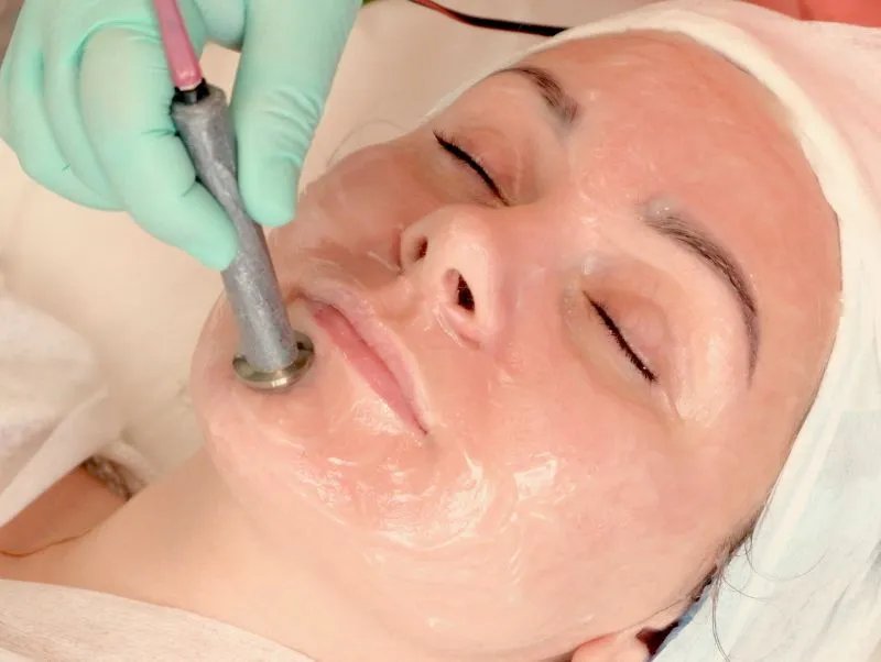 激光嫩肤有副作用吗