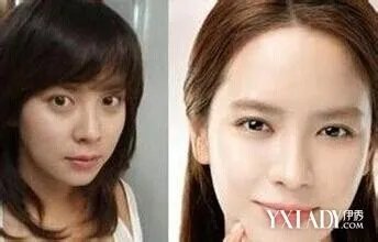 宋智孝整容了吗宋智孝整容前后对比照