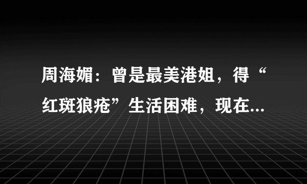 周海媚：曾是最美港姐，得“红斑狼疮”生活困难，现在她怎么样了