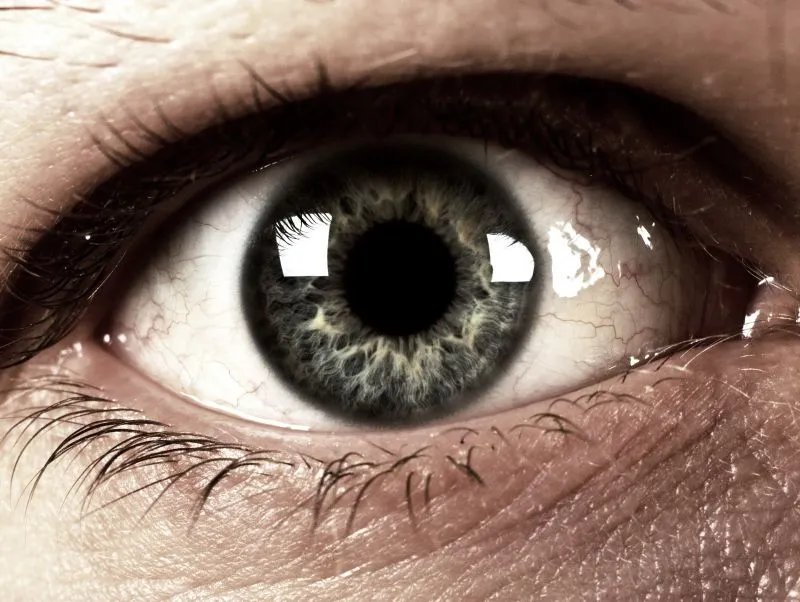 怎样去除黑眼袋