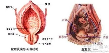 妇科症状需要治疗费用?