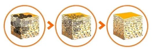 面部激光除皱怎么样，皮秒多久做一次？