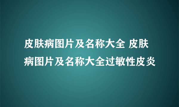 皮肤病图片及名称大全 皮肤病图片及名称大全过敏性皮炎