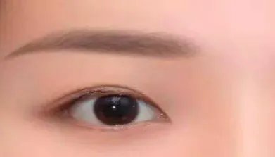 韩式翘睫双眼皮怎么护理