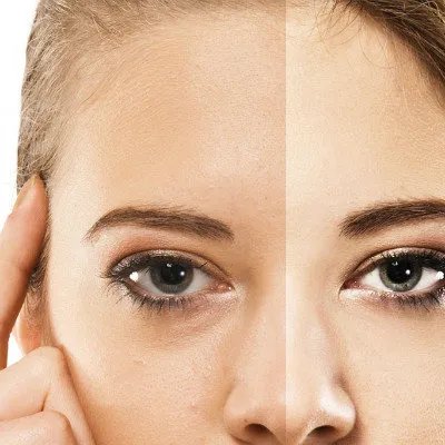 身上皮肤肤色不均怎么回事？