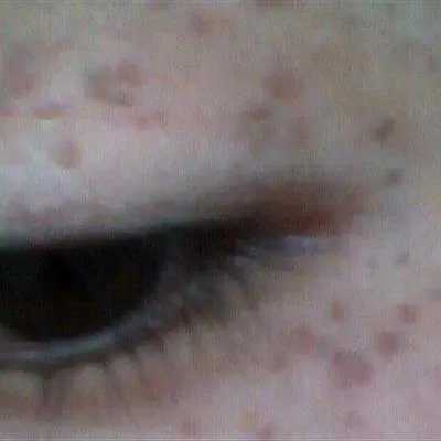 祛斑产品那种好