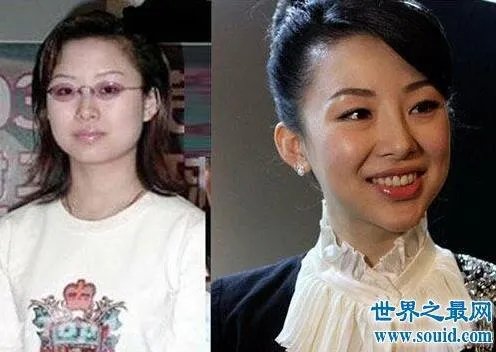 潘晓婷整容：潘晓婷一系列的整容对比照（图）