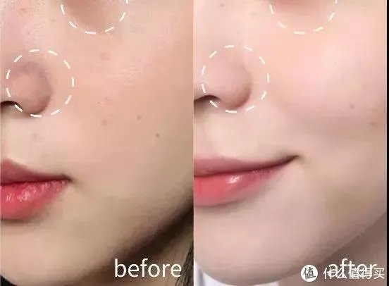 美白淡斑精华液哪个牌子比较好？十大美白祛斑产品排行榜