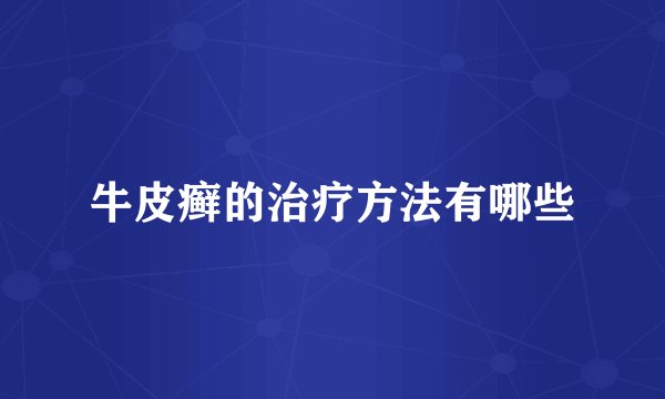 牛皮癣的治疗方法有哪些