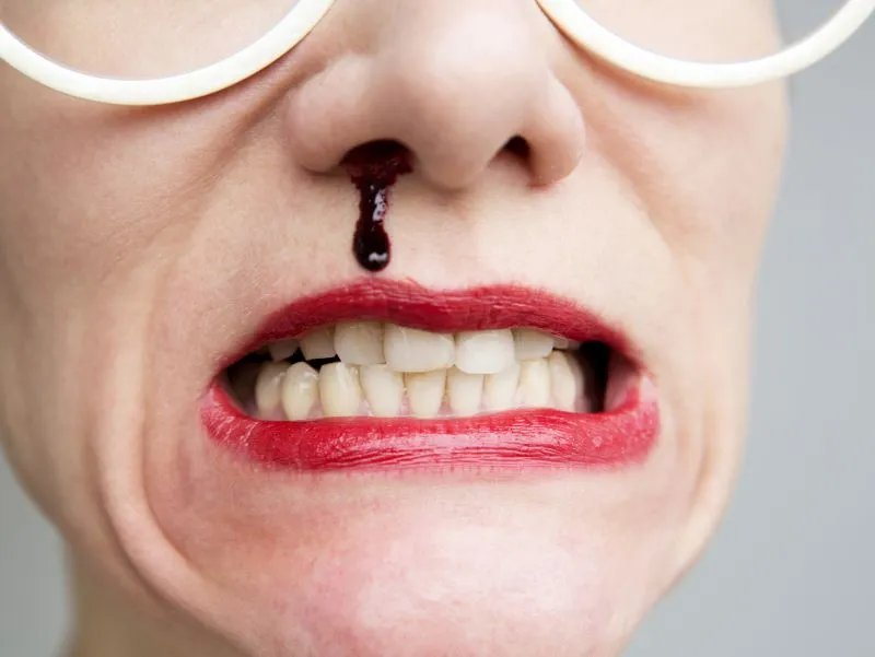 金宇彬鼻咽癌治愈复出：鼻咽癌如何治疗才最好！