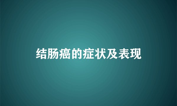 结肠癌的症状及表现