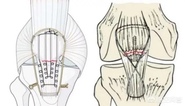饱受伤病困扰的欧文还能撑起绿衫军的未来吗？