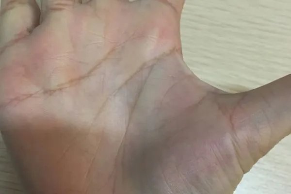 生命线越短寿命越短是真的吗？