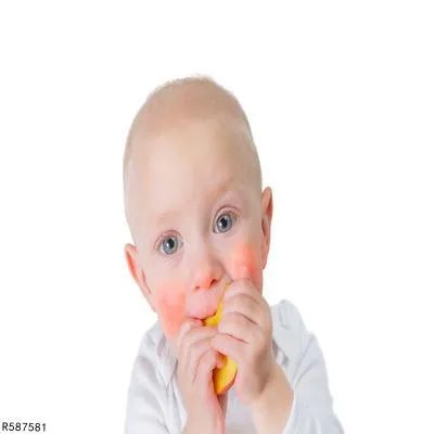 小孩子脸上红血丝多怎么办