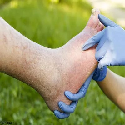 老年人手麻脚麻是怎么回事 老年人手脚麻木的病因