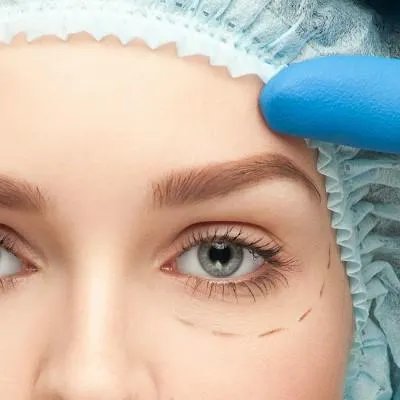 拉双眼皮最好的医院