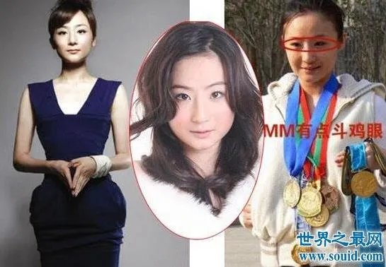 潘晓婷整容：潘晓婷一系列的整容对比照（图）