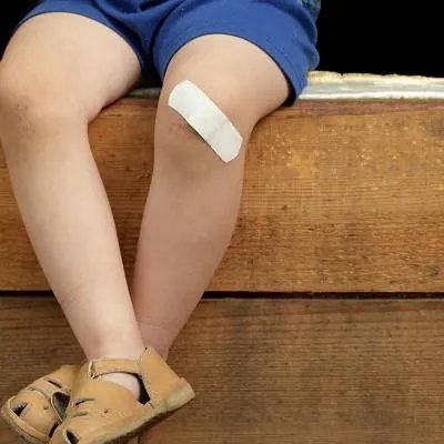 小孩包皮过长怎么办