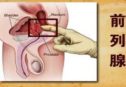 自己按摩前列腺十种手法图解