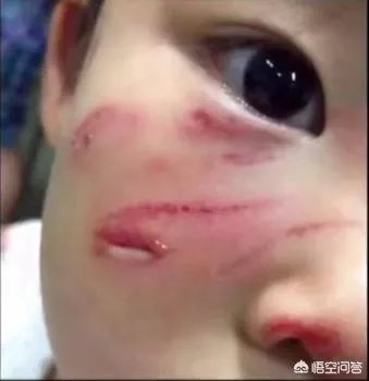 顺丰拿到国内首张无人机航空许可证,如果无人机掉下来砸到人,怎么办?