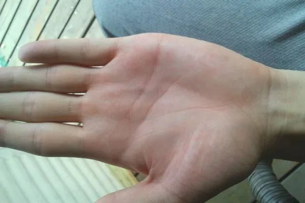 生命线越短寿命越短是真的吗？