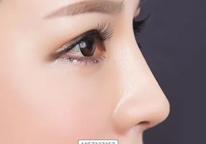 怎么能使鼻头变小