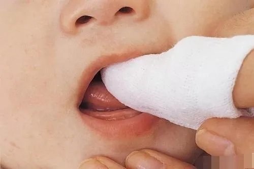 宝宝牙缝宽，都可以塞硬币了，但为什么医生说是好事？