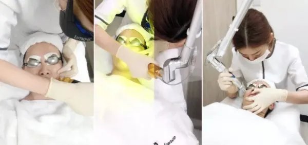 面部激光除皱怎么样，皮秒多久做一次？