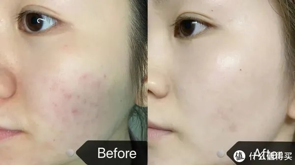 美白淡斑精华液哪个牌子比较好？十大美白祛斑产品排行榜