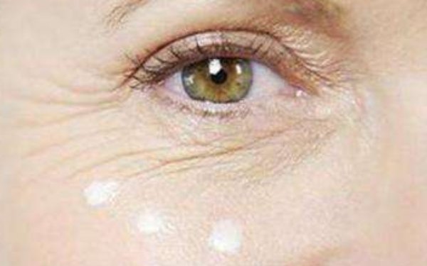 玻尿酸去除鱼尾纹效果