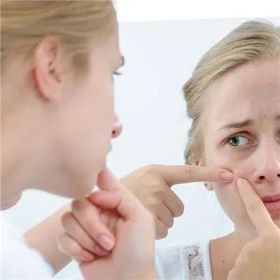 脸上有小粉刺怎么办