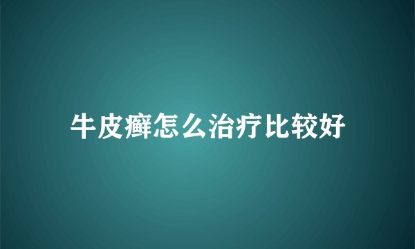 牛皮癣怎么治疗比较好