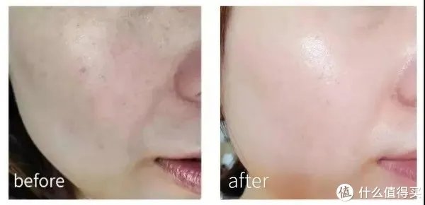 美白淡斑精华液哪个牌子比较好？十大美白祛斑产品排行榜