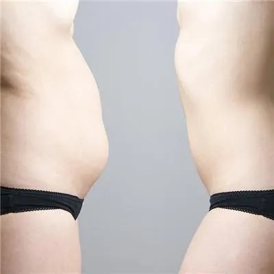 产妇减肥方法有哪些