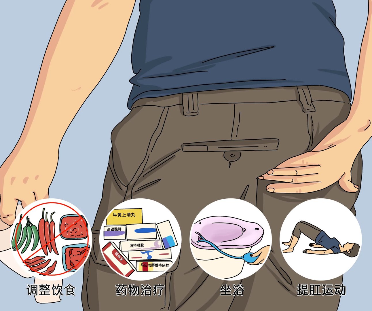 痔疮最佳不手术的治疗方式