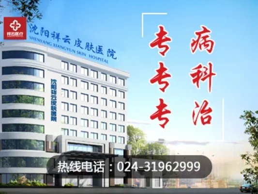 沈阳哪家医院治疗痤疮最好