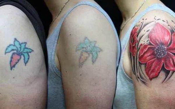 纹身可以去掉吗