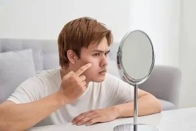 怎么治疗青春痘痤疮