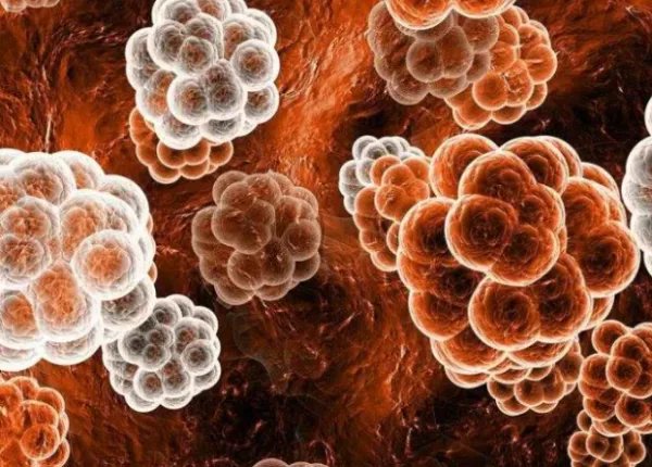 猪流感为什么会传播并且让人闻之色变？