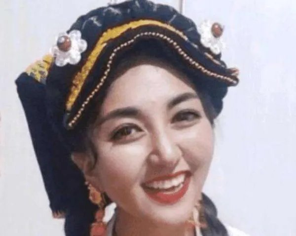 知名网红拉姆遭前夫纵火烧伤，她与前夫之间到底有何仇怨？