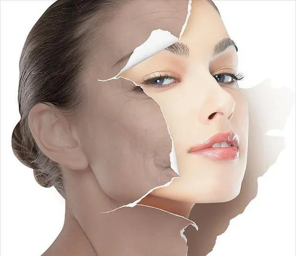 生活中常用祛斑的小窍门